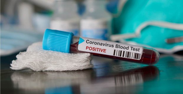 5 Dating-Tipps für die Coronavirus-Pandemie